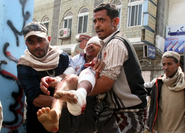 مدني من سكان تعز أصيب جراء قصف ميليشيات الحوثي وصالح للمدنيين (رويترز)