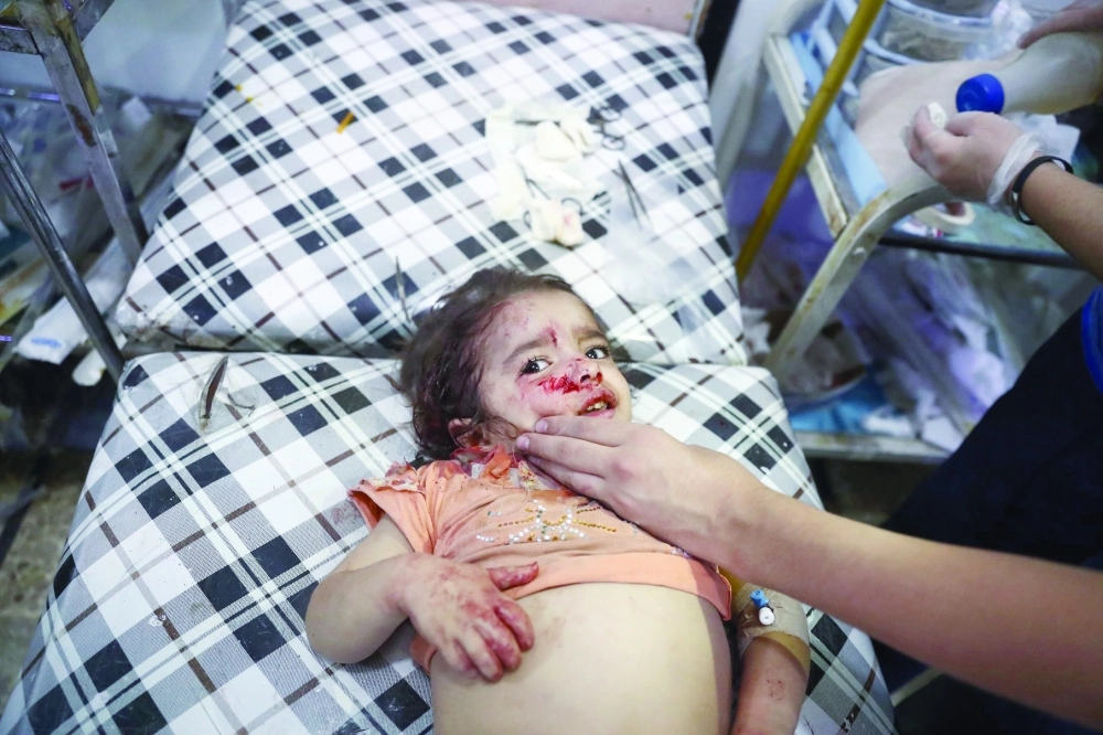 طفلة سورية مصابة بعد غارات للنظام على دوما أمس الأول                                                                        (أ ف ب)