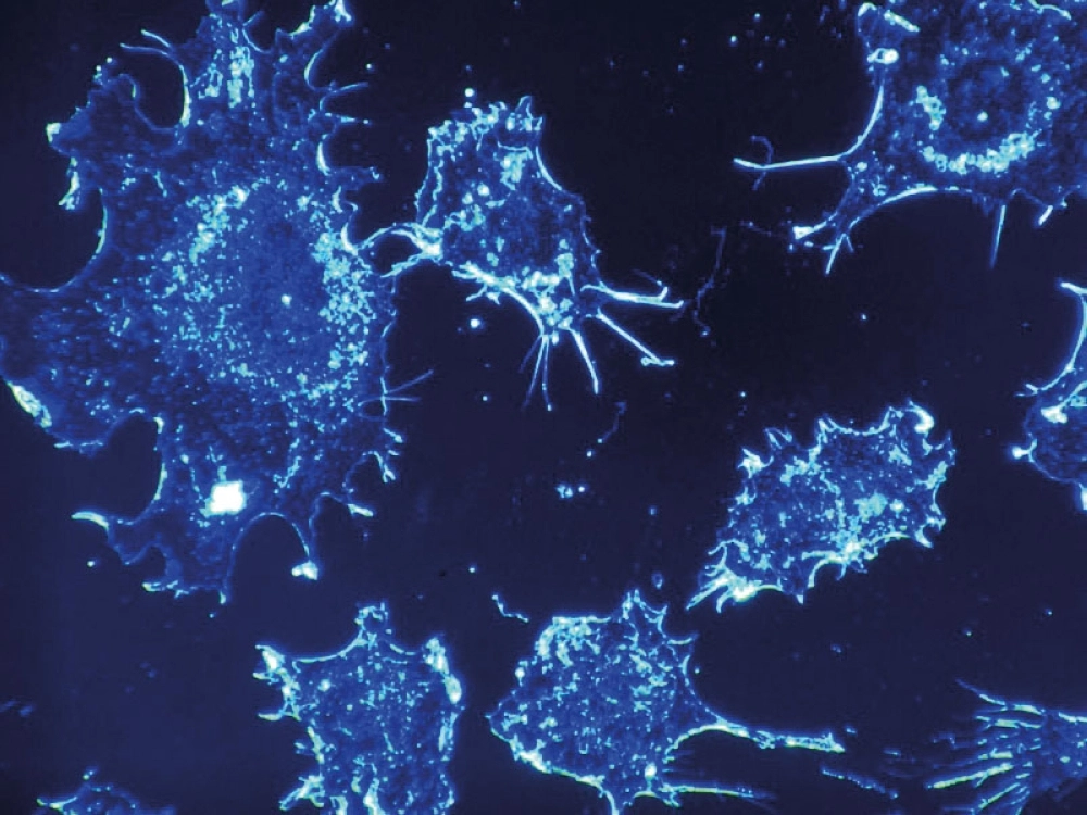 خلايا سرطان الثدي عبر تقنية الذكاء الصناعي (robohub.org) 