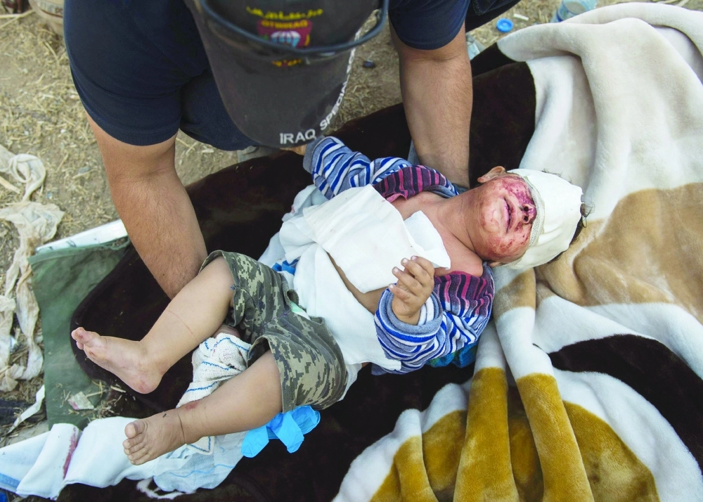 طفل تعرض لإصابات بالرأس في حي سماح بالموصل                                                  (أ ف ب)