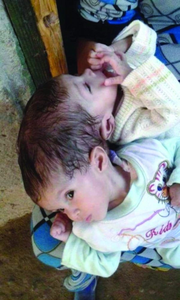 منه ومي      (واس)