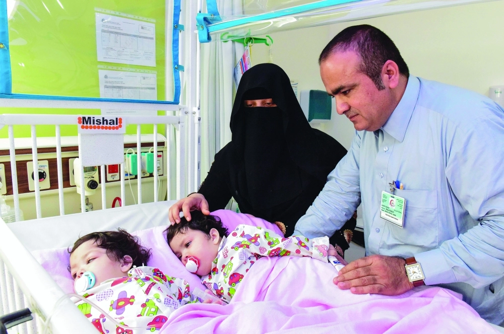 التؤام الباكستاني فاطمة ومشاعل بعد الفاصل