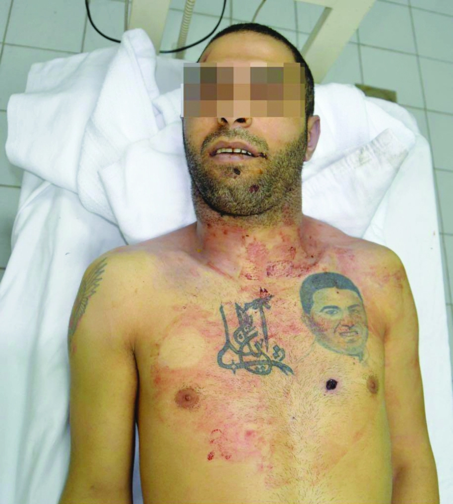 جثة مصطفى المداد 