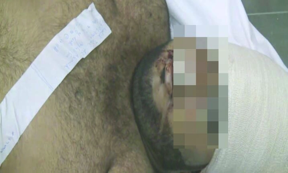 المطلوب العريض عقب مقتله                      