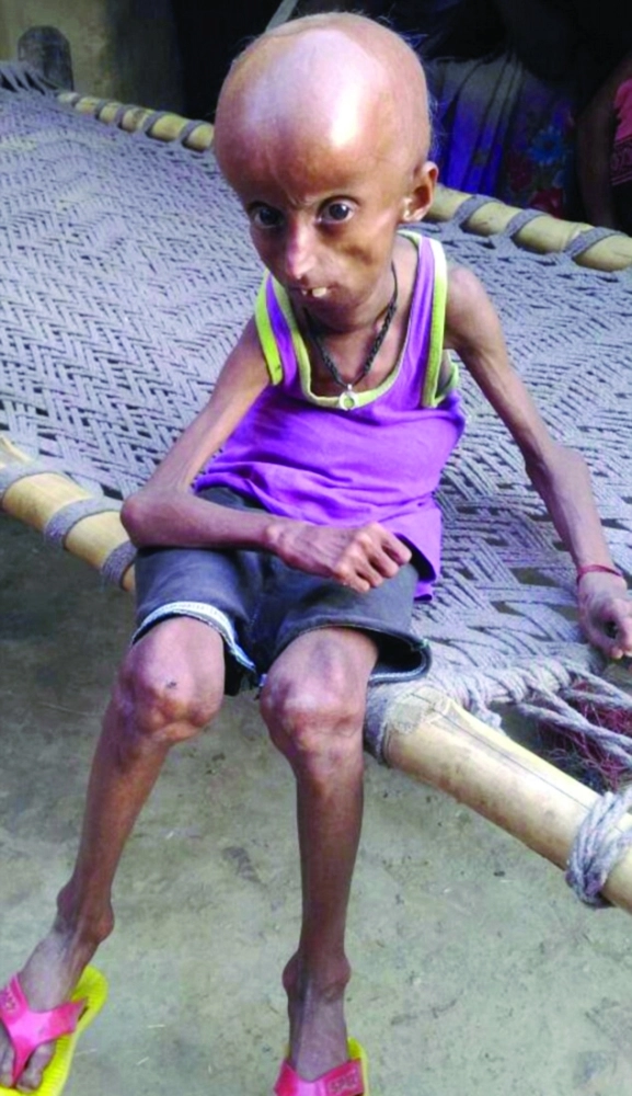 3F9D32C100000578-4446742-He_has_the_body_of_a_160_year_old_and_was_expected_to_die-a-13_1493196964941