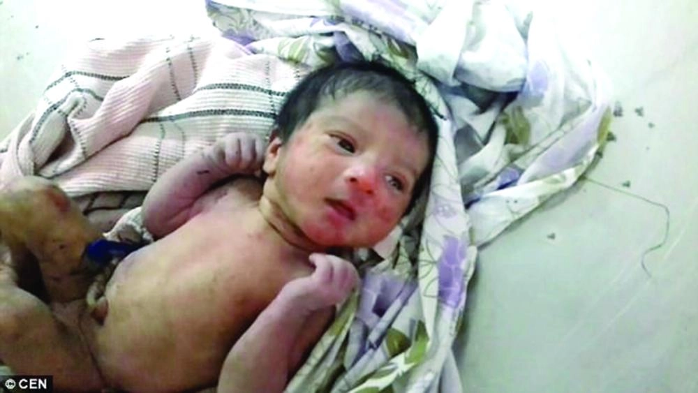 






الطفلة                          ( الديلي ميل)