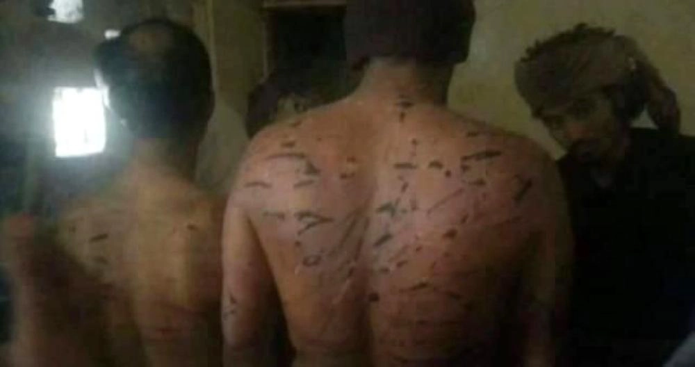 






آثار التعذيب على أحد السجناء