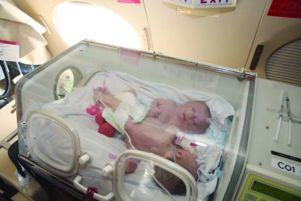 






التوأم السيامي الفلسطيني حنين وفرح