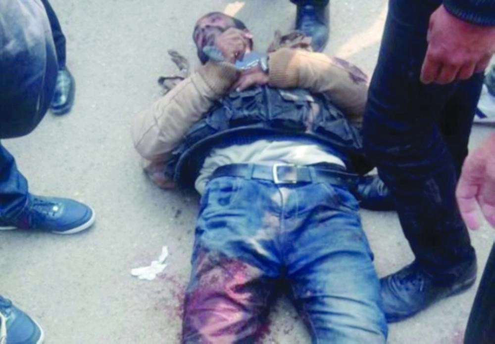 






الإرهابي المصاب في فخذه وكتفه