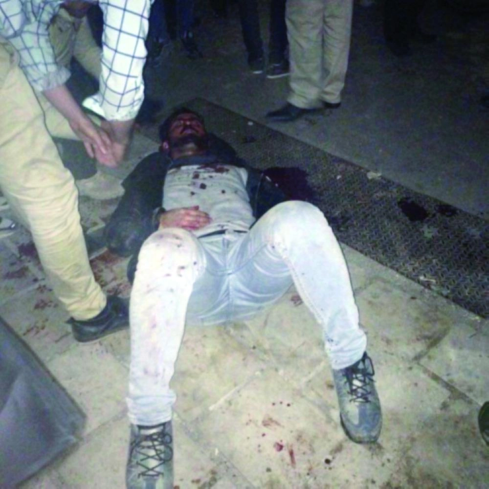 متظاهر سلمي أعزل يصارع الموت بعد اعتداء قوات خامنئي عليه