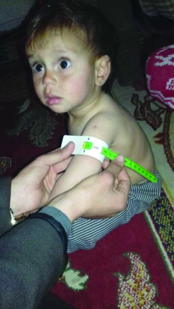 






طفل سوري يتلقى الرعاية بالغوطة (واس)