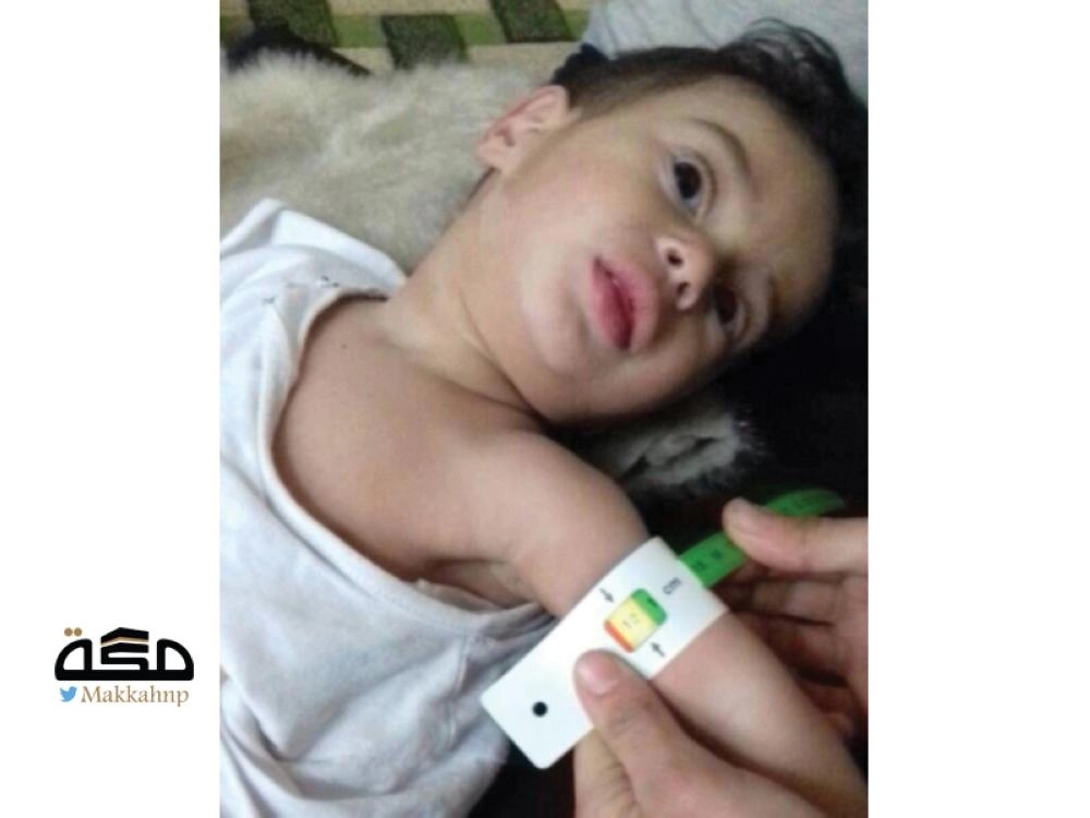 طفل سوري يتلقى العلاج في الغوطة (واس)