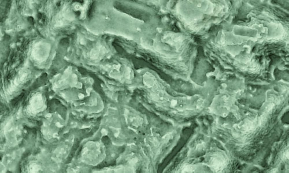 صورة مسحية لمدينة أنجاموكو