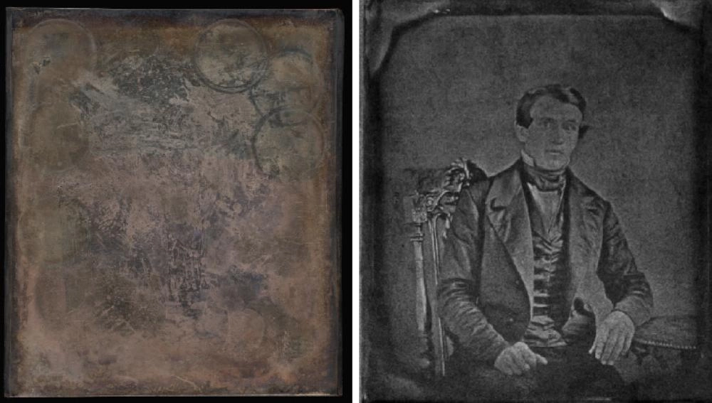 صورة للرجل قبل وبعد المعالجة (Science News)