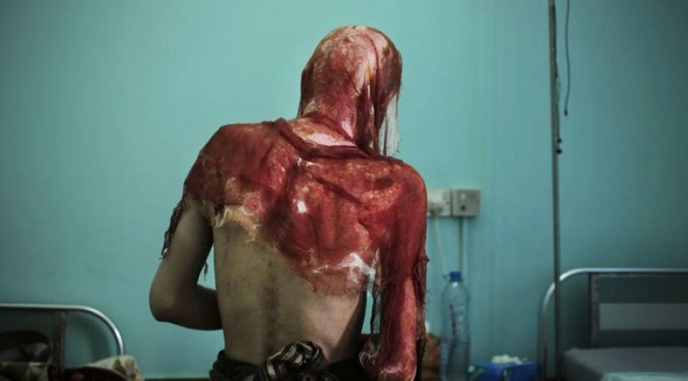 من ضحايا التعذيب الحوثي (تويتر)