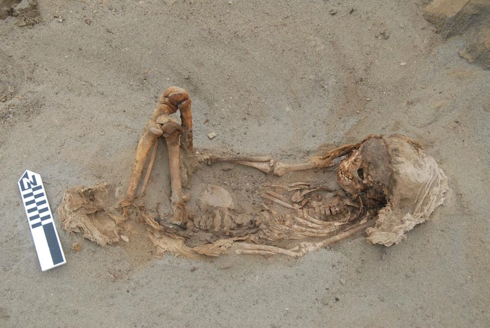 



هيكل عظمي لطفل                     (Forbes)