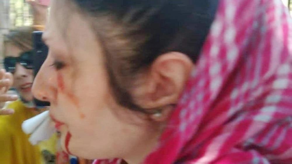 






إيرانية تعرضت للضرب من الشرطة