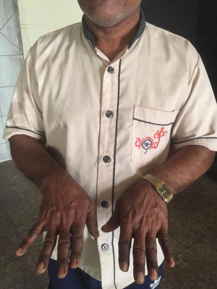 أمانة جدة تنذر 62 منشأة غذائية ضمن 69 جولة رقابية