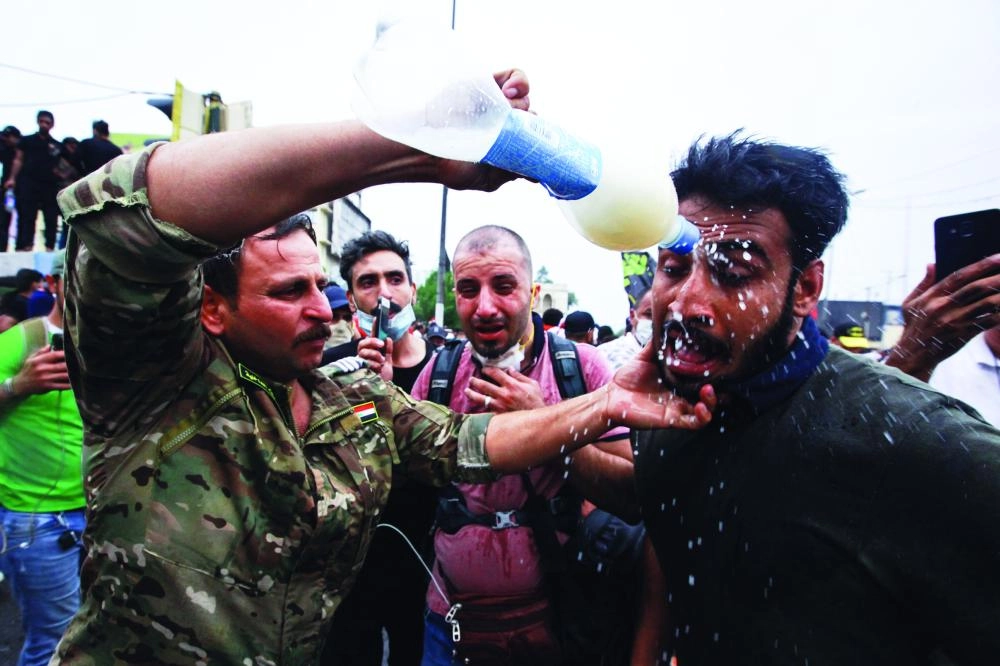 






أحد المصابين في مظاهرات العراق                                          (د ب أ)