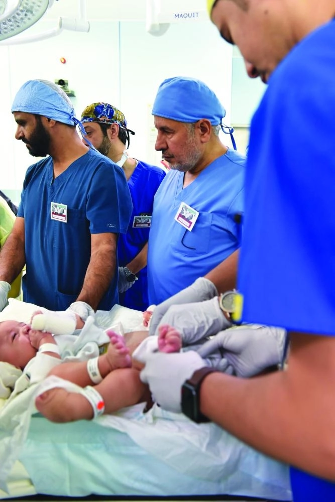 من مراحل عملية فصل التوأم السيامي الليبي                                                             (واس)