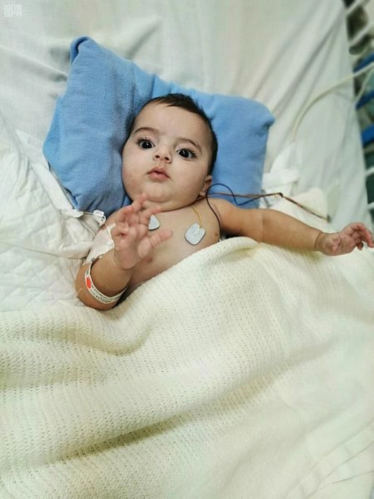 التوأم السيامي الليبي