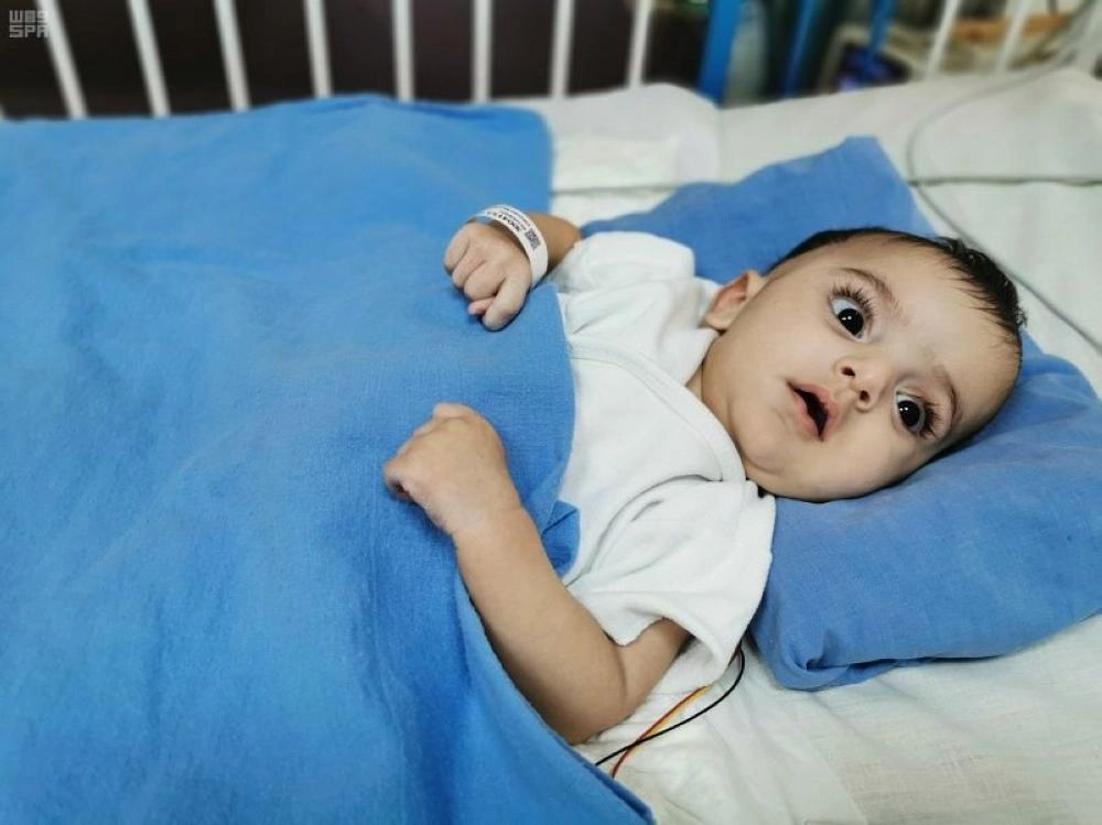 التوأم السيامي الليبي