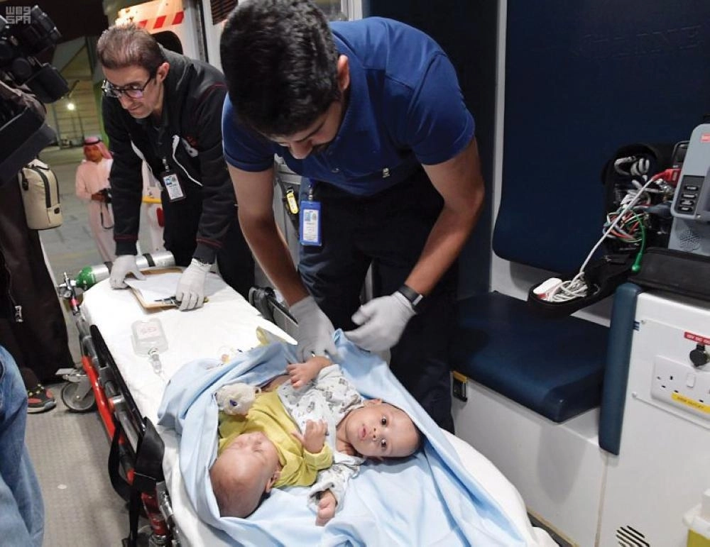 التوأم السيامي الموريتاني