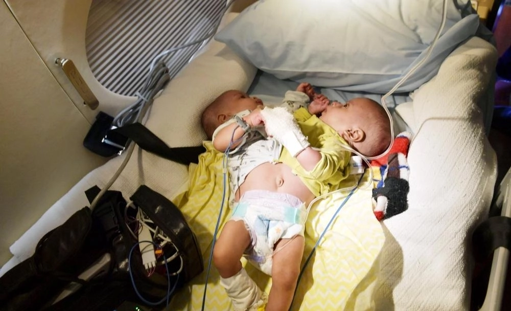 التوأم السيامي الموريتاني لدى وصوله (مكة)