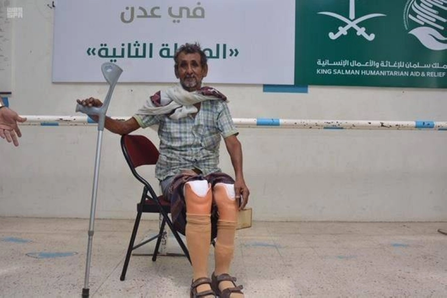 يمني يستفيد من الأطراف الصناعية (واس)