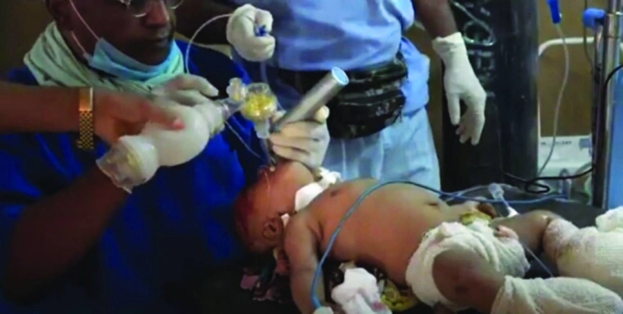 






أحد ضحايا مجزرة الحوثي                                            (مكة)