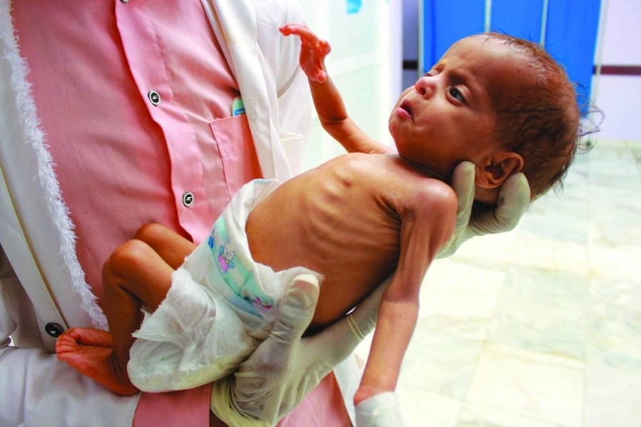 






طفل يمني يعاني الجوع والمرض                                                    (مكة)