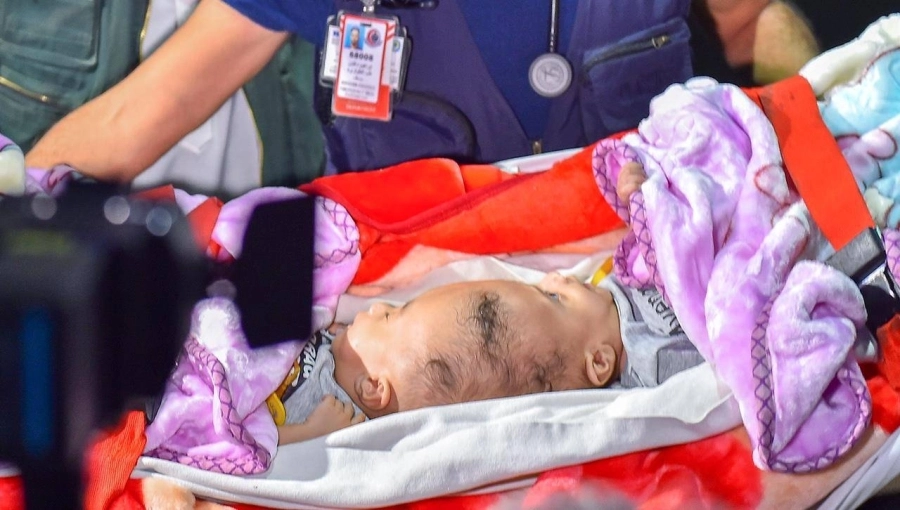 






لحظة وصول التوأم السيامي إلى قاعدة الملك سلمان الجوية بالرياض أمس            (مكة)