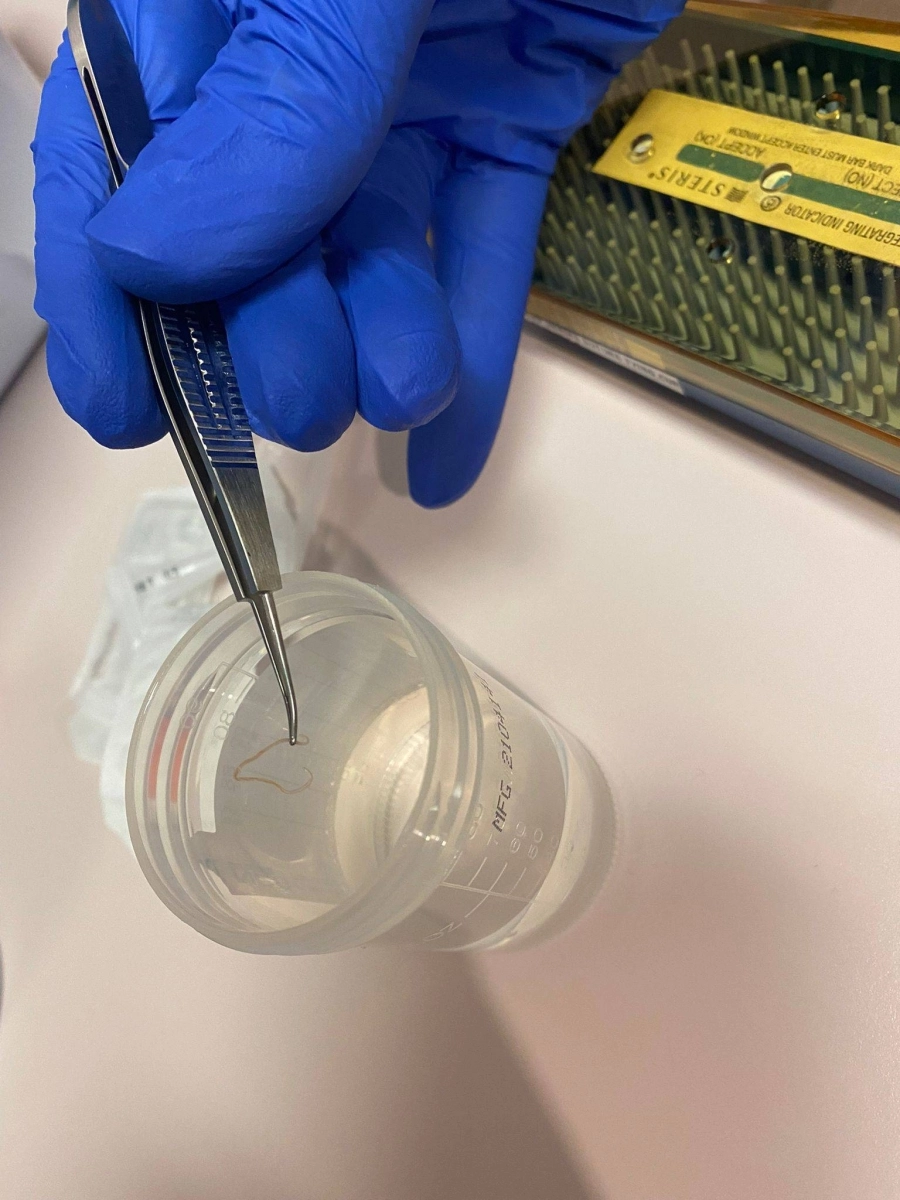 الدودة بعد استخراجها (مكة)