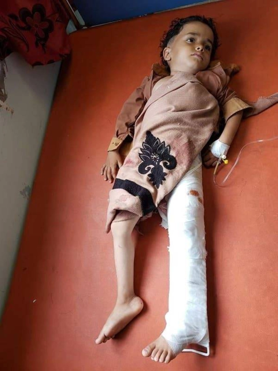 أحد الأطفال ضحايا قذائف الحوثي بتعز (مكة)