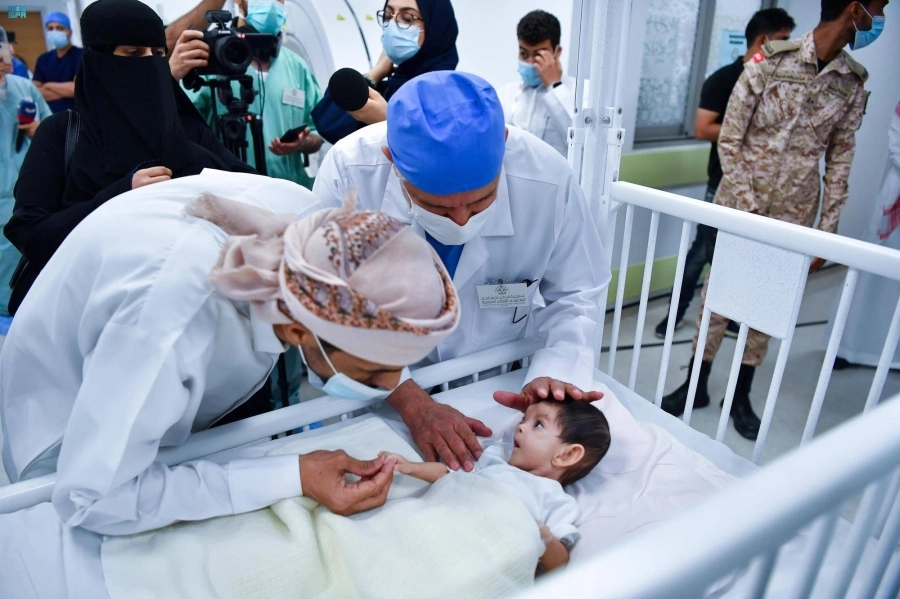 التوأم الطفيلي