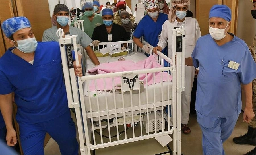 نجاح عملية فصل التوأم الطفيلي اليمني (واس)