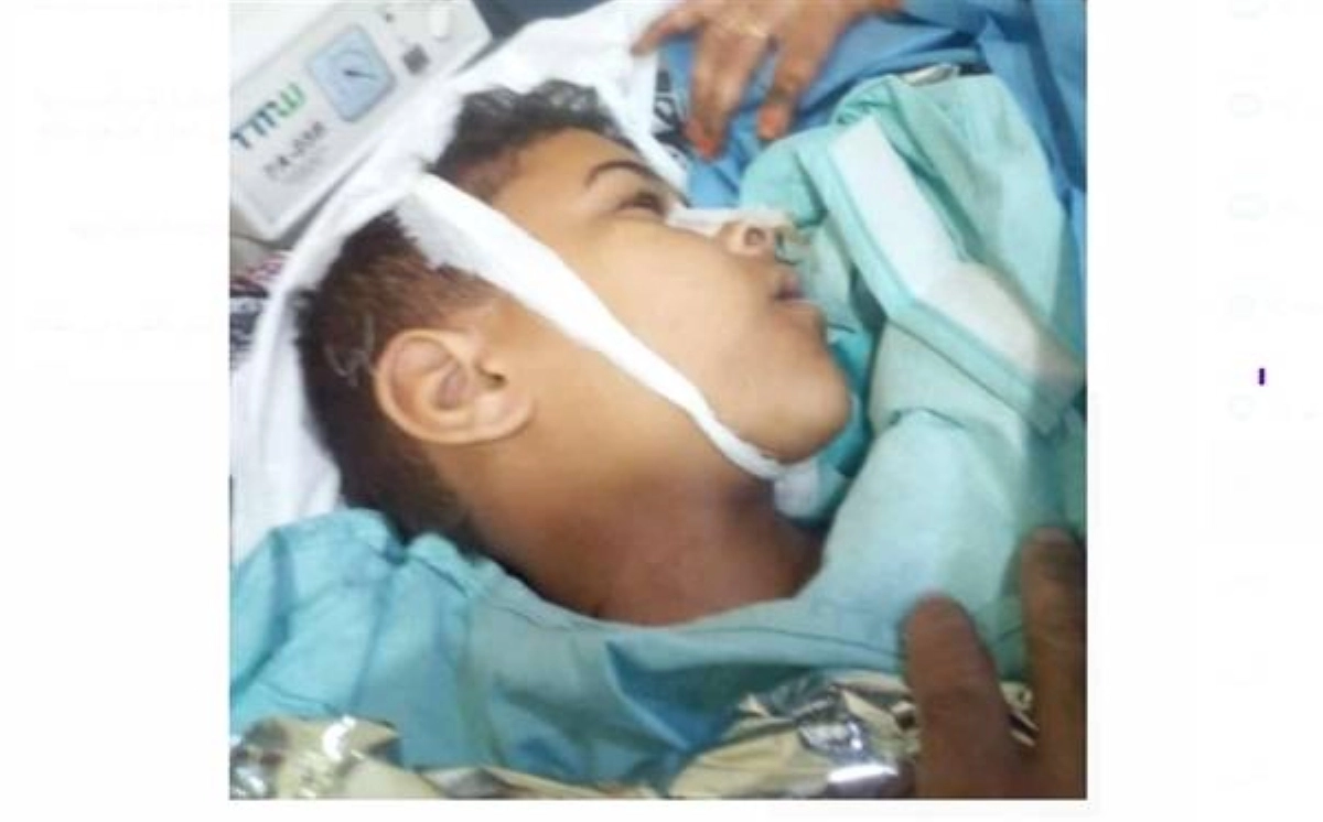 

طفل ضحية مسيرات الحوثي بالضالع                         (مكة)