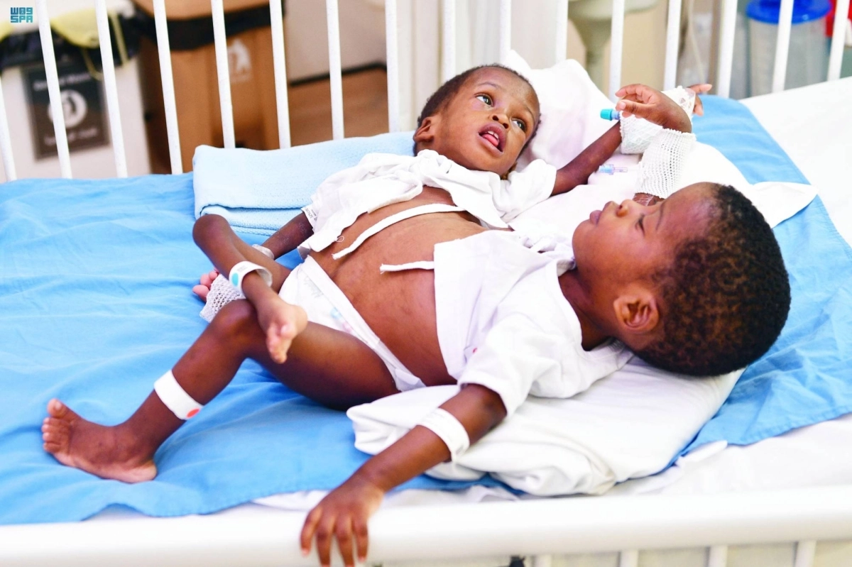 


التوأم السيامي التنزاني                              (مكة)      