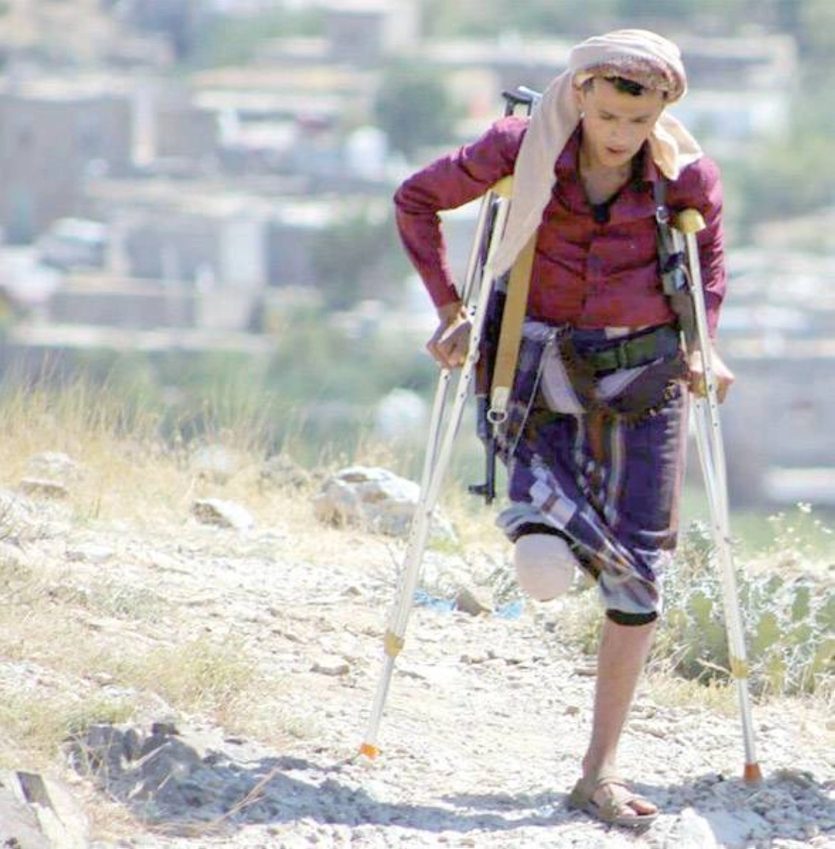 أحد ضحايا الألغام في اليمن (مكة)