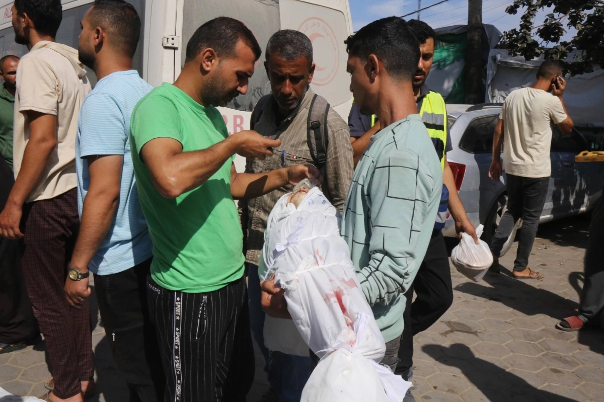 أحد شهداء الجوع في رفح