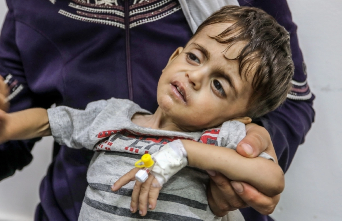 طفل غزاوي مصاب بالسرطان يستعد للمغادرة إلى مصر (د ب أ)