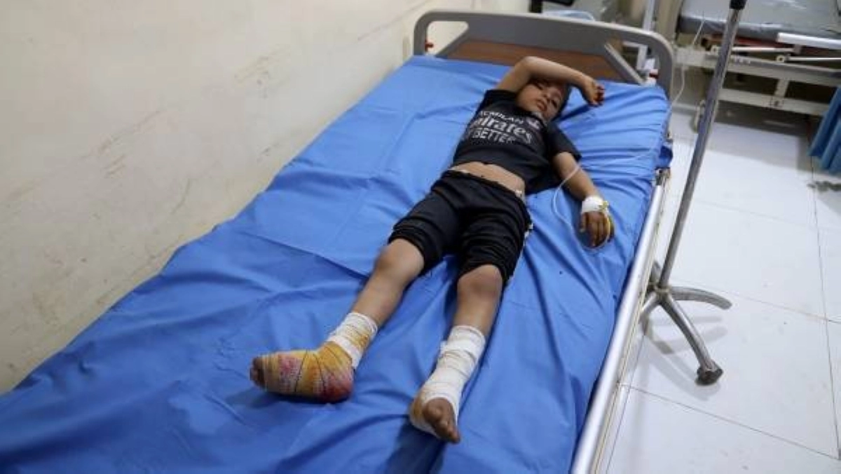 أحد الأطفال المصابين