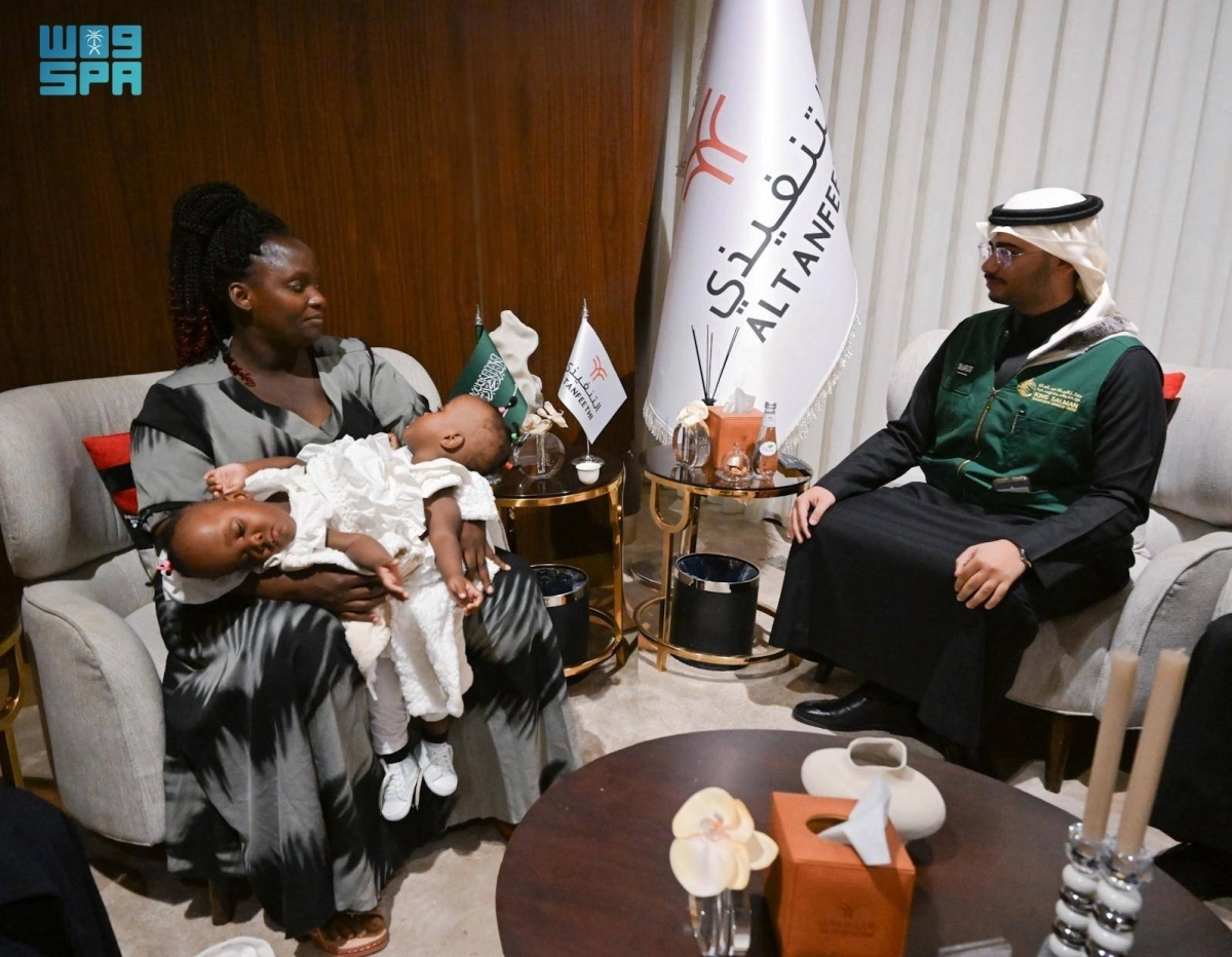 التوأم الملتصق التنزاني (نانسي ونايس)