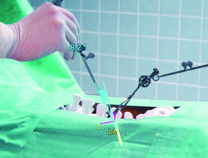 Holo_Surgery_2