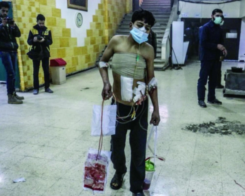 فتى يتلقى العلاج في ظل الصعوبات التي يواجهها السوريون بالغوطة الشرقية (تويتر)