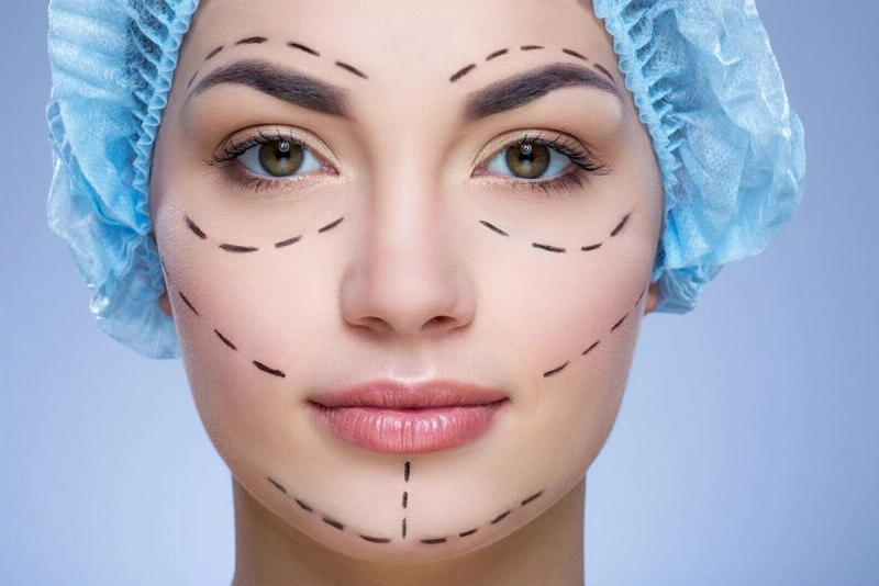 تخطيط لعملية تجميل (shutterstock)