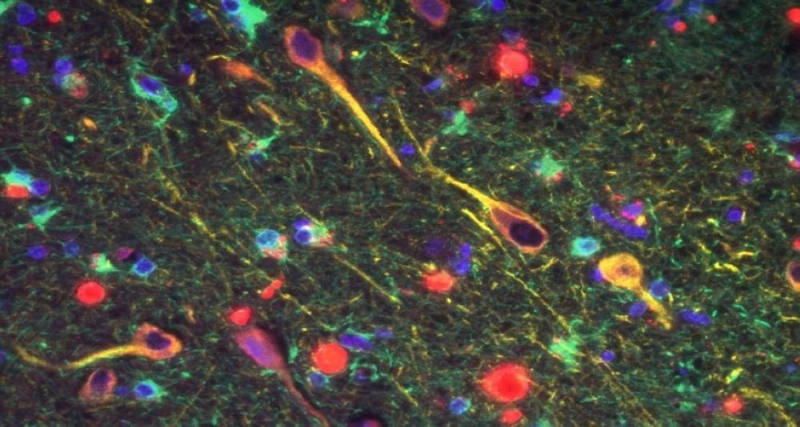 بكتيريا (SCIENCE NEWS )