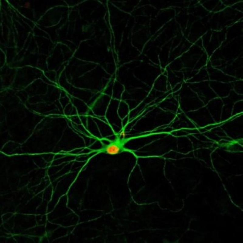 الخلايا العصبية (Science daily)