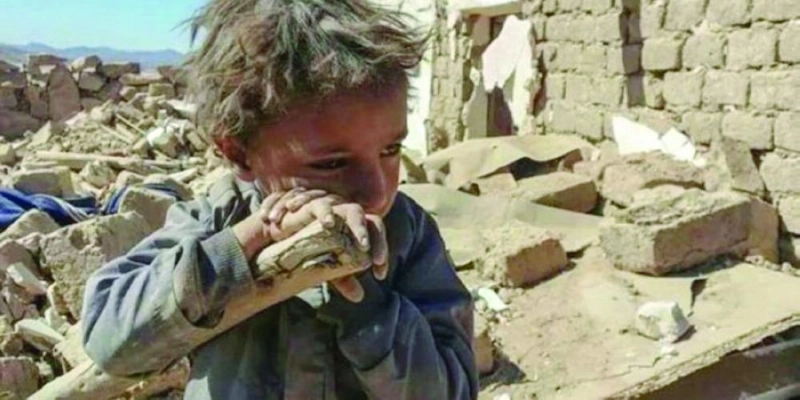 أطفال اليمن يعانون (مكة)