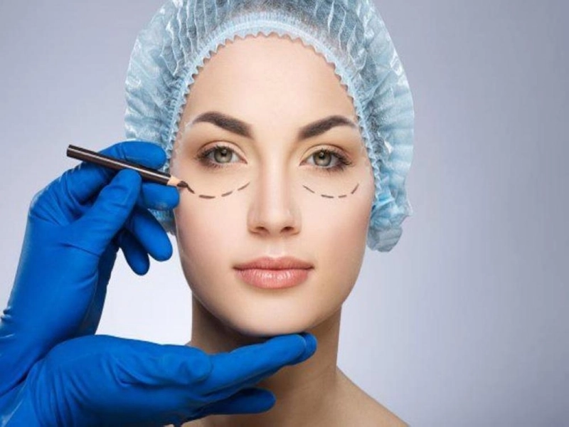 صورة توضيحية لعملية تجميل